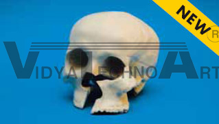 Skull, with holder, defect